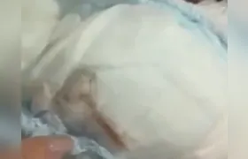 Mãe encontra animal morto em fralda de bebê; Entenda