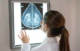 SUS amplia acesso à mamografia a mulheres de 40 a 49 anos