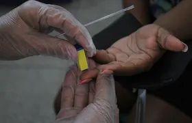 São Gonçalo faz ações de conscientização sobre hepatites virais