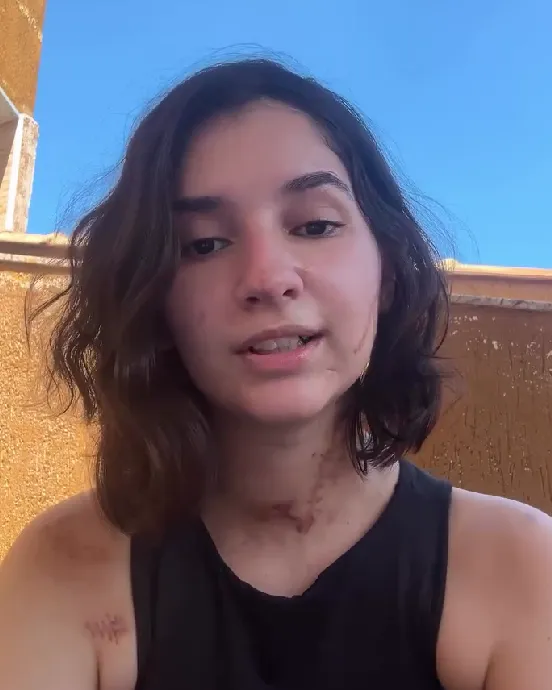 Alana Anísio Rosa, de 20 anos