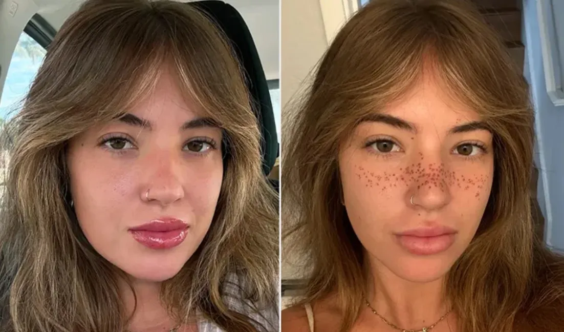 A criadora de conteúdo resolveu tatuar sardas em seu rosto