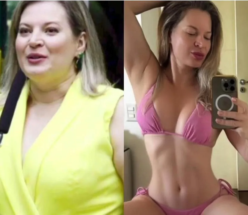 Antes e depois da ex-deputada federal Joice Hasselmann