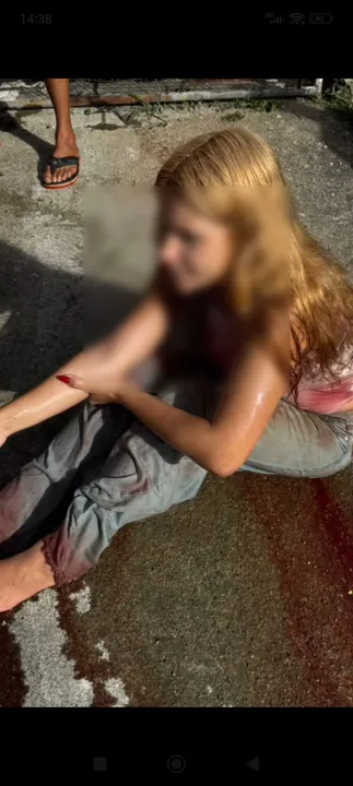 Mulher fica ferida após incêndio