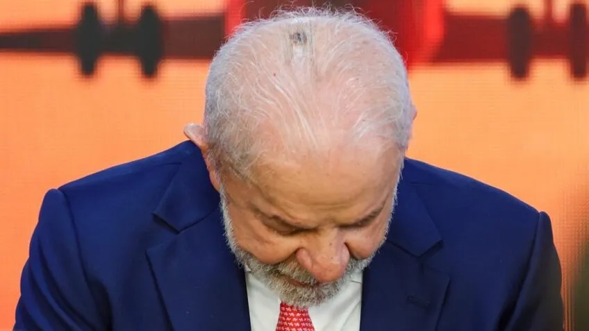 Presidente Lula retirou lesão de câncer no couro cabeludo