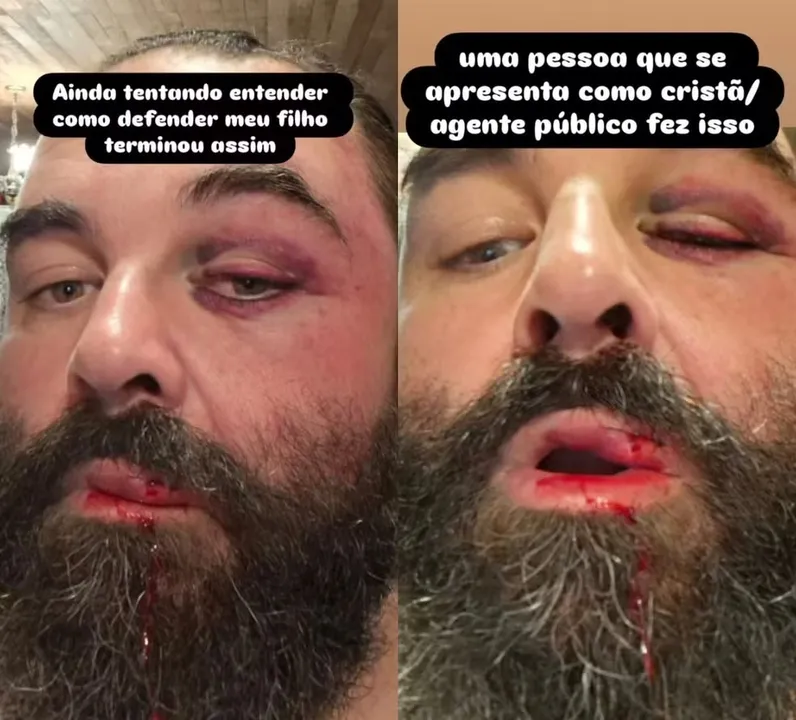 Vítima mostrou ferimentos em publicação nas redes sociais
