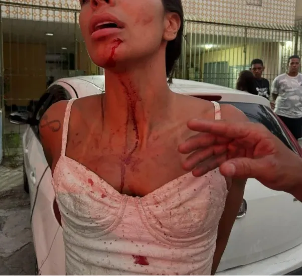 “Recebi um soco no rosto, caí no chão e, mesmo assim, ainda fui chutada”, escreveu