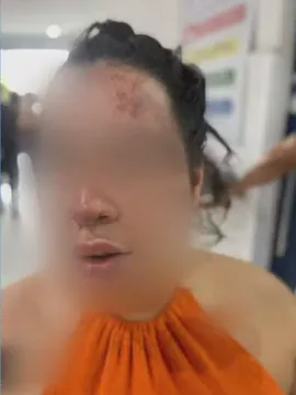 O agressor é um ex-companheiro que atingiu com socos, tapas e chute