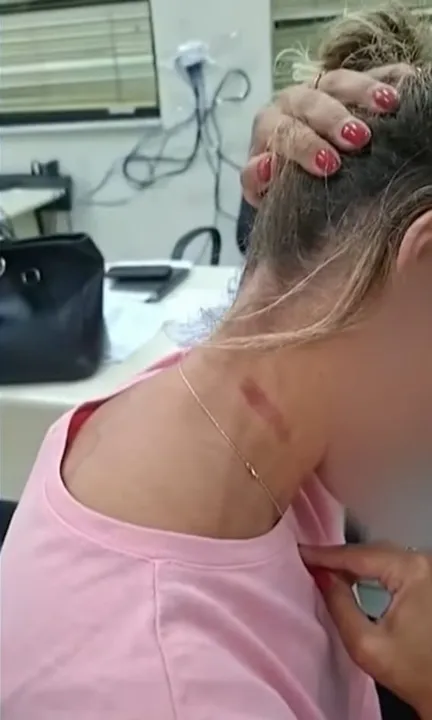 Uma mulher não identificada foi vítima de agressão física praticada por um policial civil