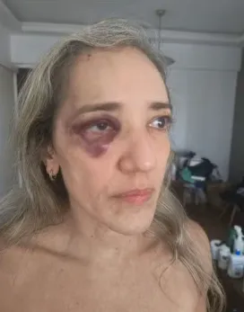 A vítima sofreu ferimentos e precisou ser levada ao Hospital Municipal Miguel Couto, na Gávea, mas já foi liberada