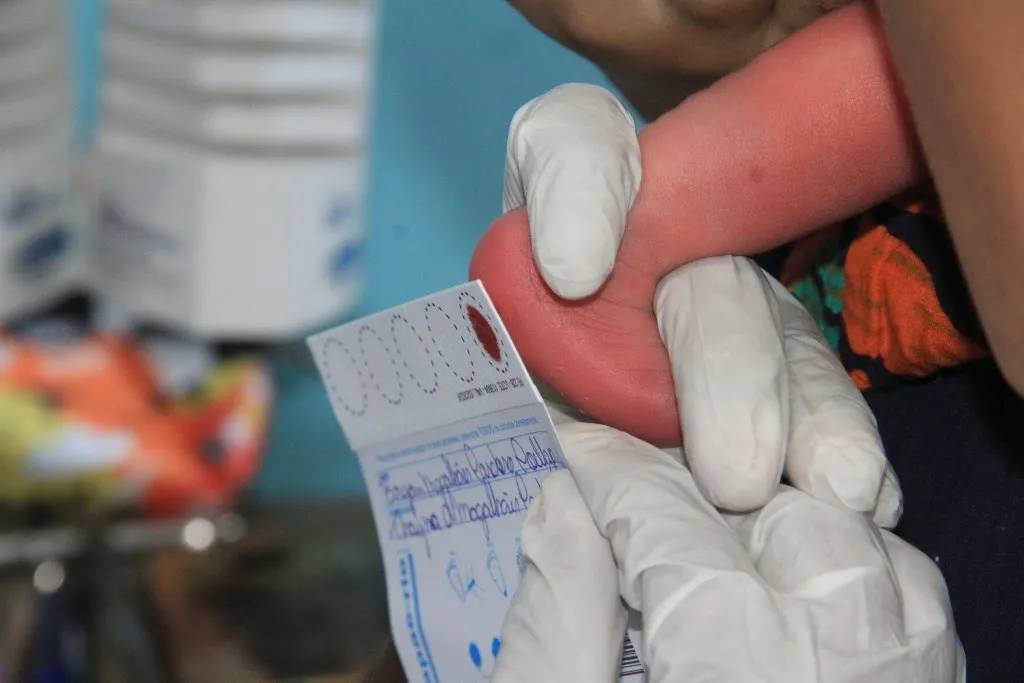 O exame faz parte da triagem neonatal e é oferecido, gratuitamente, pelo Sistema Único de Saúde (SUS) em sete unidades em São Gonçalo