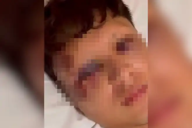 Imagens que circulam nas redes sociais mostram o jovem com diversos hematomas no rosto