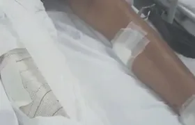 Adolescente de 15 anos é ferido por granada lançada por drone na Zona Norte do Rio