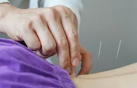 Brasil regulamenta exercício profissional da acupuntura