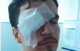 Jovem atingido por bala de borracha por PM após jogo de Flamengo x Vasco perde a visão do olho direito