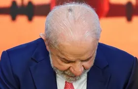 Lula retira lesão de câncer no coro cabeludo e tem alta hospitalar