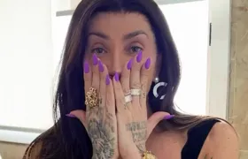 Maya Massafera mostra o rosto pela primeira vez após retirada de ossos do maxilar