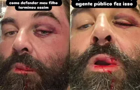 Morador é agredido por fiel após reclamar de barulho de igreja
