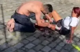 Moradora de condomínio é atacada por pitbull em São Pedro da Aldeia