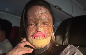 Morre Karine Felipe, influencer que lutava contra doença rara