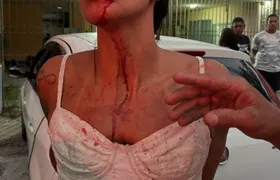 Mulher acusa jogador de futebol de agressão durante confusão em bar no Rio