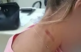 Mulher é agredida por ex-marido policial civil em Niterói