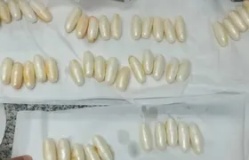 Passageiro é detido no Galeão após ingerir dezenas de cápsulas de cocaína