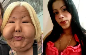 Quem é 'Juju do Pix', influenciadora que passou por cirurgia para retirar óleo mineral do rosto