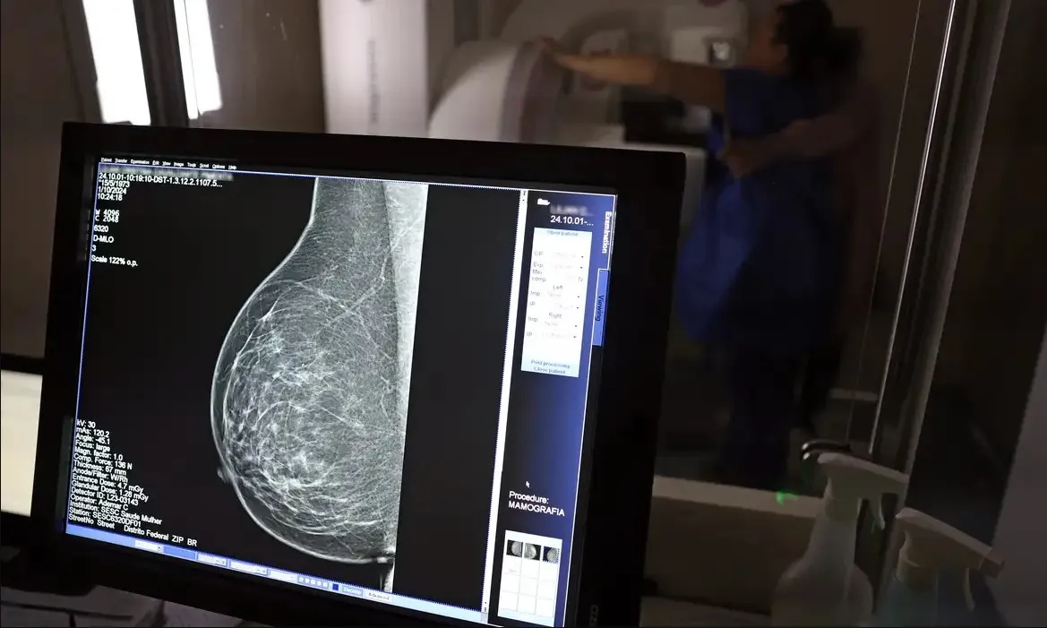 Leis asseguram diagnóstico rápidos e tratamento no SUS para pacientes com câncer de mama