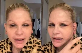 Monique Evans alega que banco não reconheceu seu rosto após cirurgia plástica