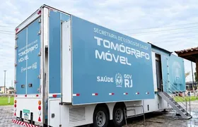 São Gonçalo recebe a carreta da tomografia a partir desta quinta-feira