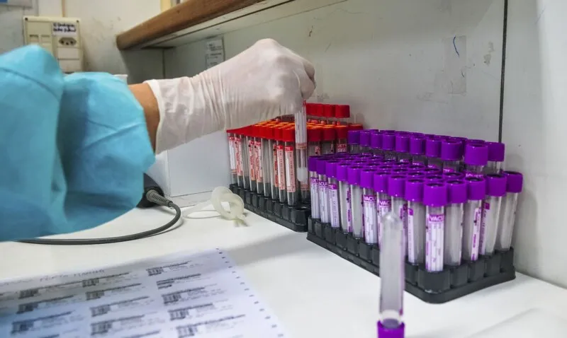 O objetivo da pesquisa é fazer com o que o teste sorológico seja mais acessível