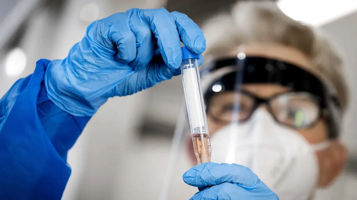 O plasma é retirado do sangue de paciente curados do Covid-19