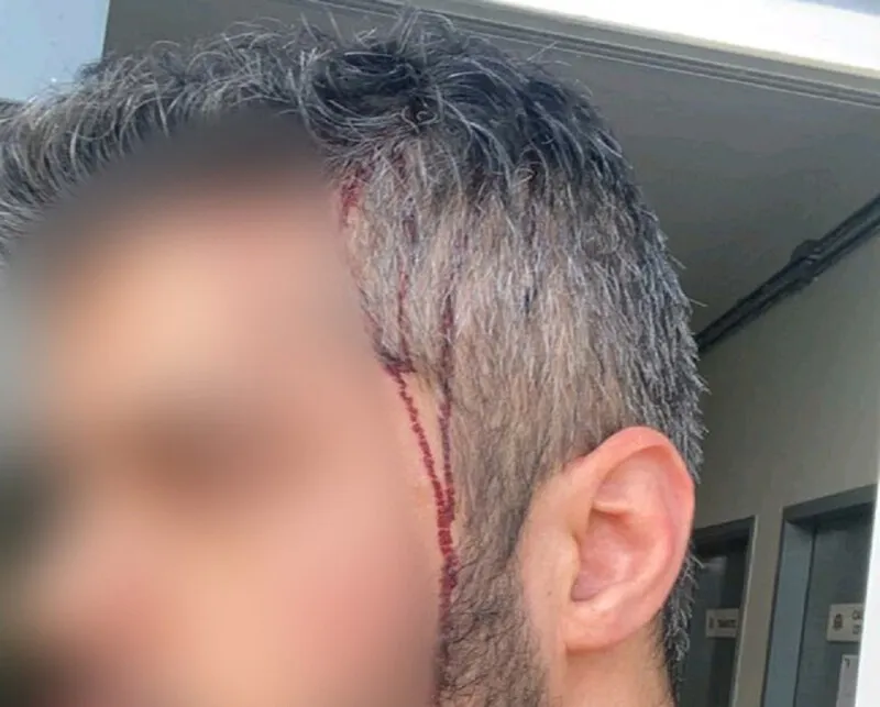 Orestes atacou o homem com um pedaço de madeira