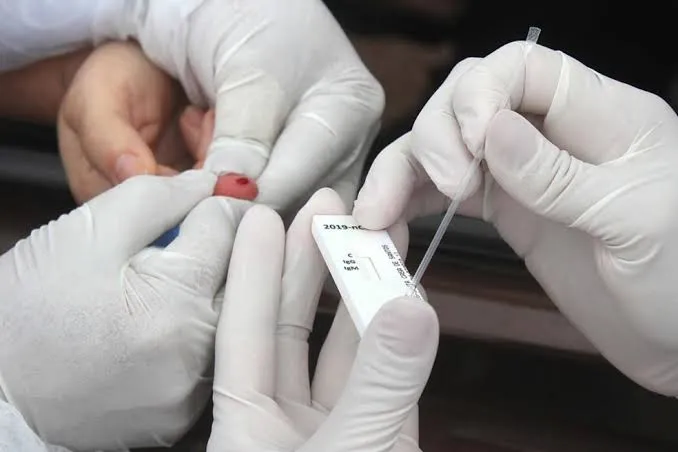 A testagem será iniciada a partir desta sábado (7)