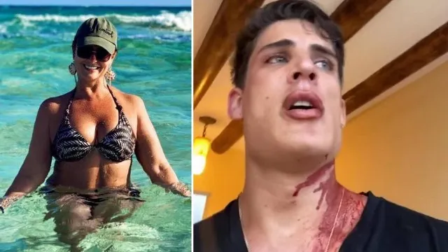 O modelo foi esfaqueado em uma confusão dentro um restaurante local