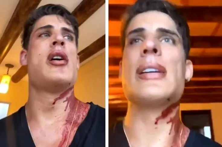 O rapaz afirma ter sido agredido por 2 homens e um terceiro teria o esfaqueado