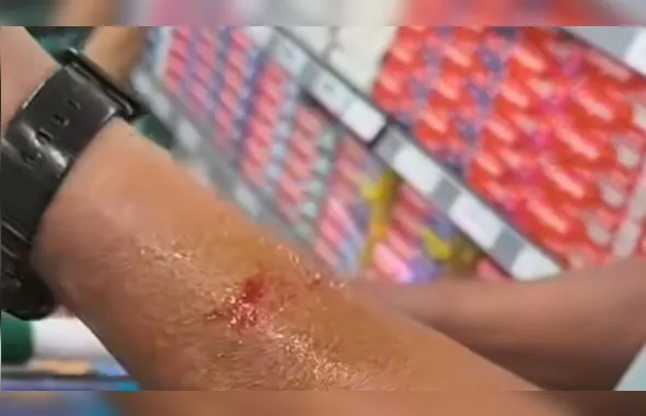 Ninho de ratos cai sobre cliente em supermercado de Niterói