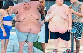 Gordão da XJ se prepara para cirurgia bariátrica após perder 100kg em um ano
