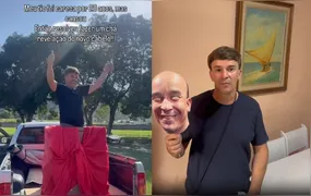 Gonçalense comenta sucesso viral de "chá-revelação" de prótese capilar