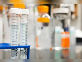 Lula veta exigência de exame toxicológico para CNH nas categorias A e B