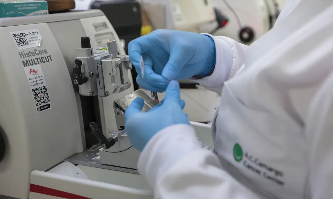 Essa é a forma mais comum da leucemia aguda em adultos e atinge, principalmente, pacientes idosos