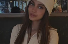 Anitta aparece com rosto diferente e foto "viraliza": 'Não consigo mais reconhecer'