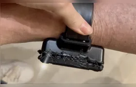 Laudo da PF confirma que Bolsonaro usou solda para romper tornozeleira