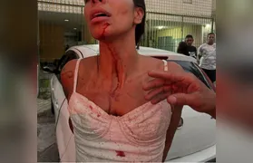 Mulher acusa jogador de futebol de agressão durante confusão em bar no Rio