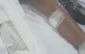Adolescente de 15 anos é ferido por granada lançada por drone na Zona Norte do Rio