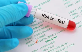 Anchieta terá exame gratuito de diabetes com resultado em 20 minutos