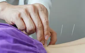 Brasil regulamenta exercício profissional da acupuntura