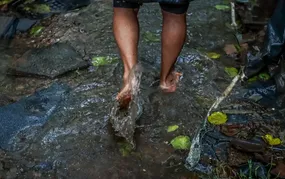 Cuidado: Saúde de São Gonçalo alerta para sintomas de leptospirose