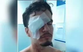 Jovem atingido por bala de borracha por PM após jogo de Flamengo x Vasco perde a visão do olho direito