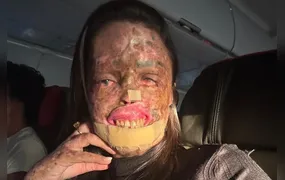 Morre Karine Felipe, influencer que lutava contra doença rara